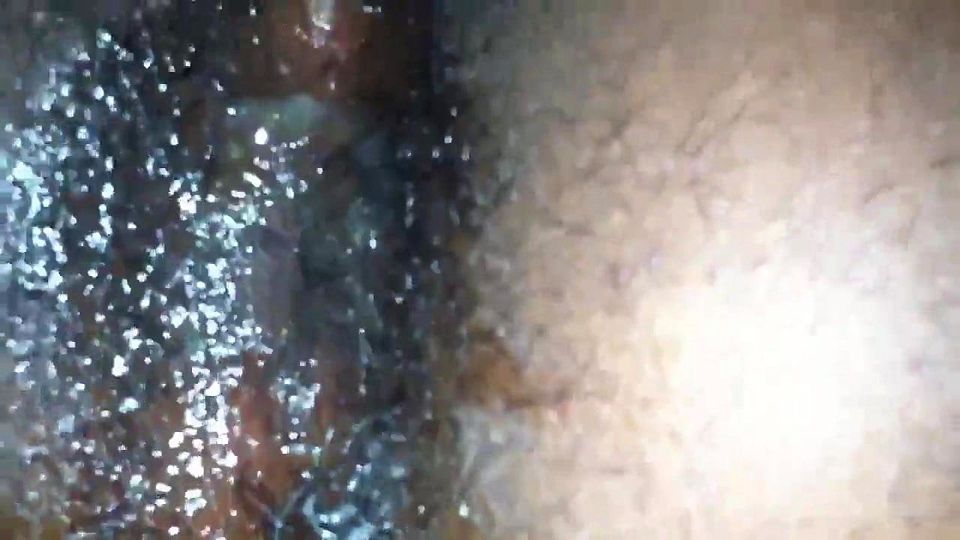 Hairy Anal