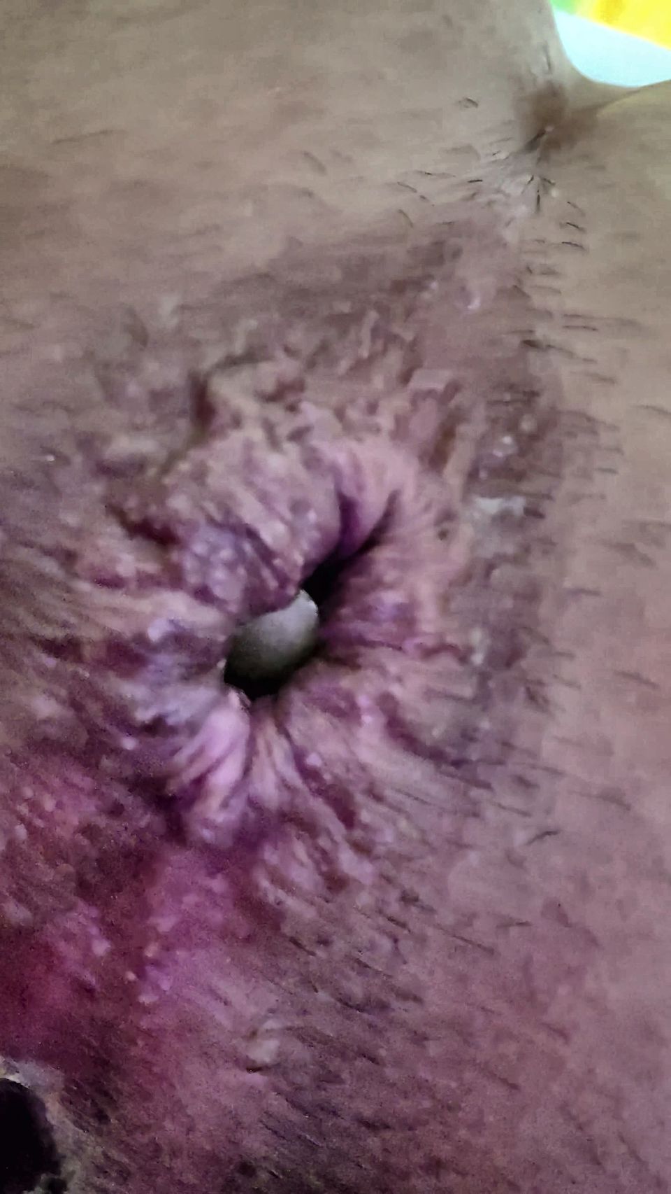 Close-up of a bottle inserted into the anus...
