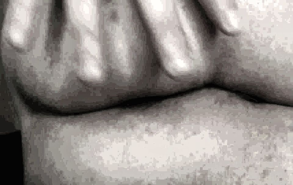 Hairy Butthole Winking