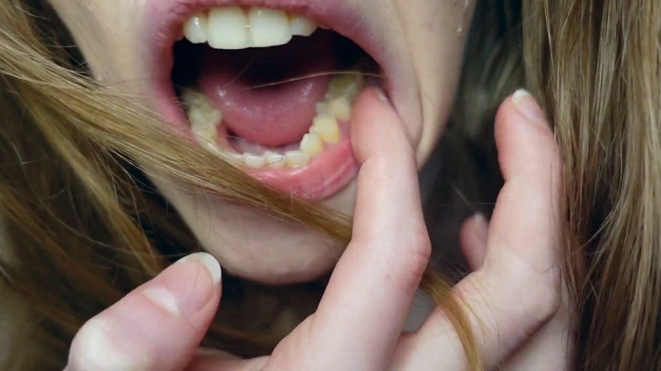 I Tell You About the Fillings in My Teeth and Dental Visits